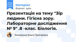 Презентація на тему "Зір людини. Гігієна зору. Лабораторне дослідження № 9" .8 -клас. Біологія.