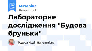 Лабораторне дослідження "Будова бруньки"