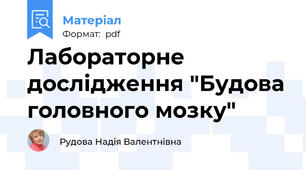 Лабораторне дослідження "Будова головного мозку"