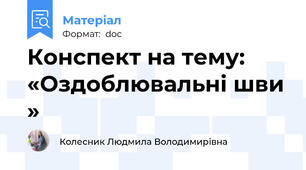 Конспект на тему: «Оздоблювальні шви »