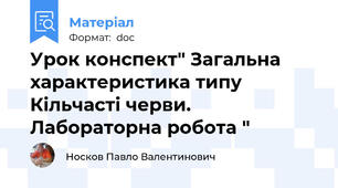 Урок конспект" Загальна характеристика типу Кільчасті черви.  Лабораторна робота "