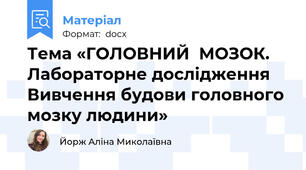 Тема «ГОЛОВНИЙ  МОЗОК.  Лабораторне дослідження Вивчення будови головного мозку людини»