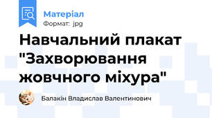 Навчальний плакат "Захворювання жовчного міхура"