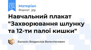Навчальний плакат "Захворювання шлунку та 12-ти палої кишки"