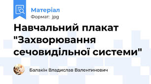 Навчальний плакат "Захворювання сечовидільної системи"