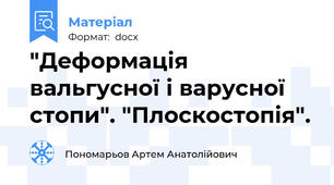 "Деформація вальгусної і варусної стопи". "Плоскостопія".