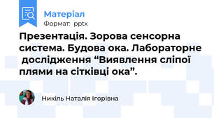 Презентація. Зорова сенсорна система. Будова ока. Лабораторне  дослідження “Виявлення сліпої плями на сітківці ока”.