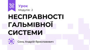 НЕСПРАВНОСТІ ГАЛЬМІВНОЇ СИСТЕМИ