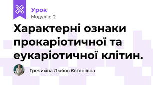 Характерні ознаки прокаріотичної та еукаріотичної клітин.