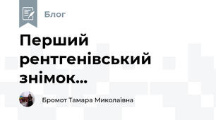 Перший  рентгенівський знімок...